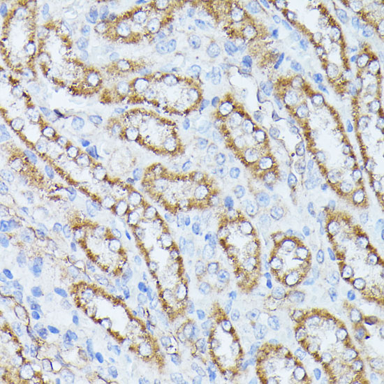PP2A Catalytic B Beta Rabbit polyclonal antibody