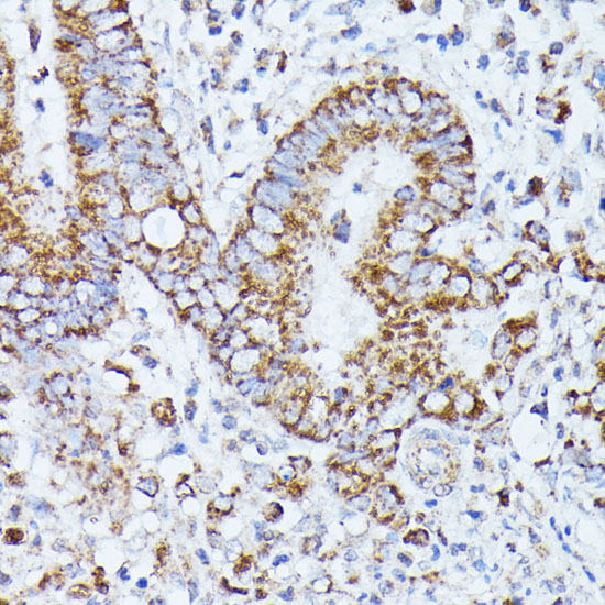 PP2A Catalytic B Beta Rabbit polyclonal antibody