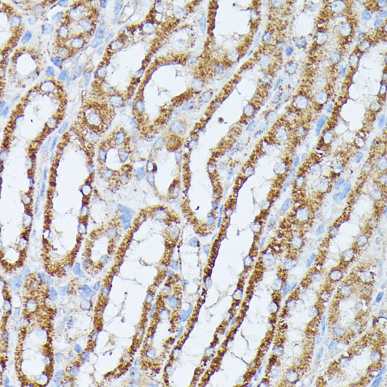 PP2A Catalytic B Beta Rabbit polyclonal antibody
