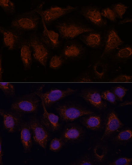 PP2A Catalytic B Beta Rabbit polyclonal antibody