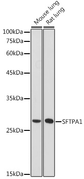 SFTPA1 Rabbit polyclonal antibody