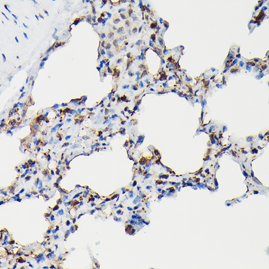 SFTPA1 Rabbit polyclonal antibody