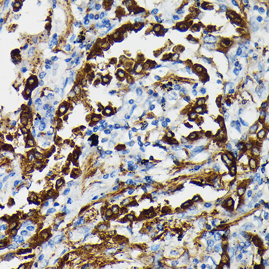 SFTPA1 Rabbit polyclonal antibody