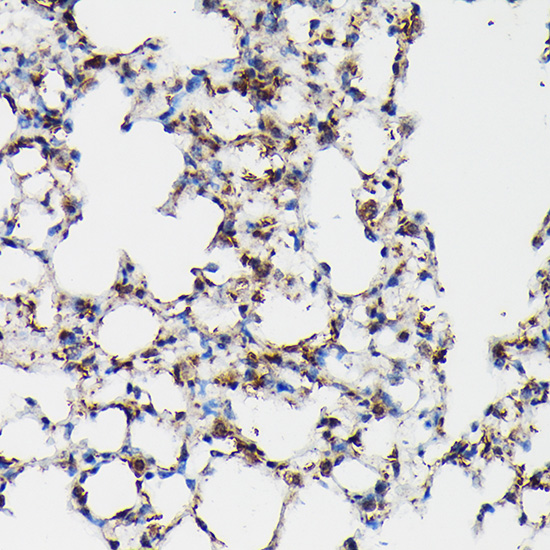SFTPA1 Rabbit polyclonal antibody