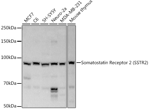 Somatostatin Receptor 2 (SSTR2) Rabbit polyclonal antibody