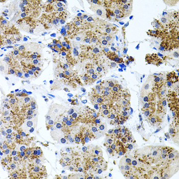 Somatostatin Receptor 2 (SSTR2) Rabbit polyclonal antibody