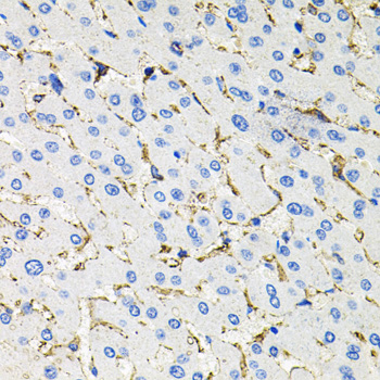 Somatostatin Receptor 2 (SSTR2) Rabbit polyclonal antibody