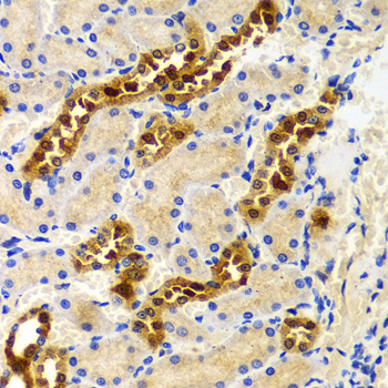 PIWIL4 Rabbit polyclonal antibody