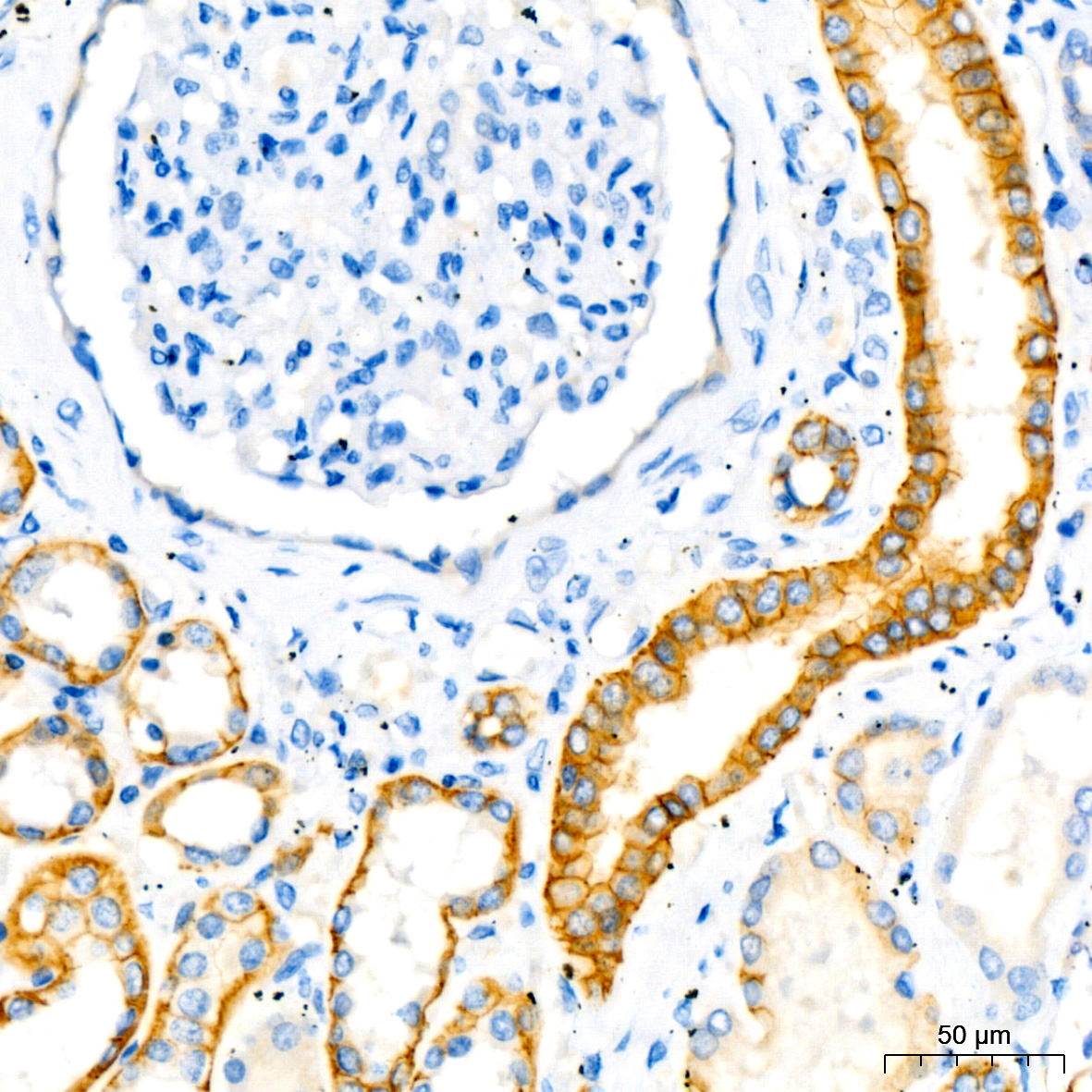 E-Cadherin mouse monoclonal antibody