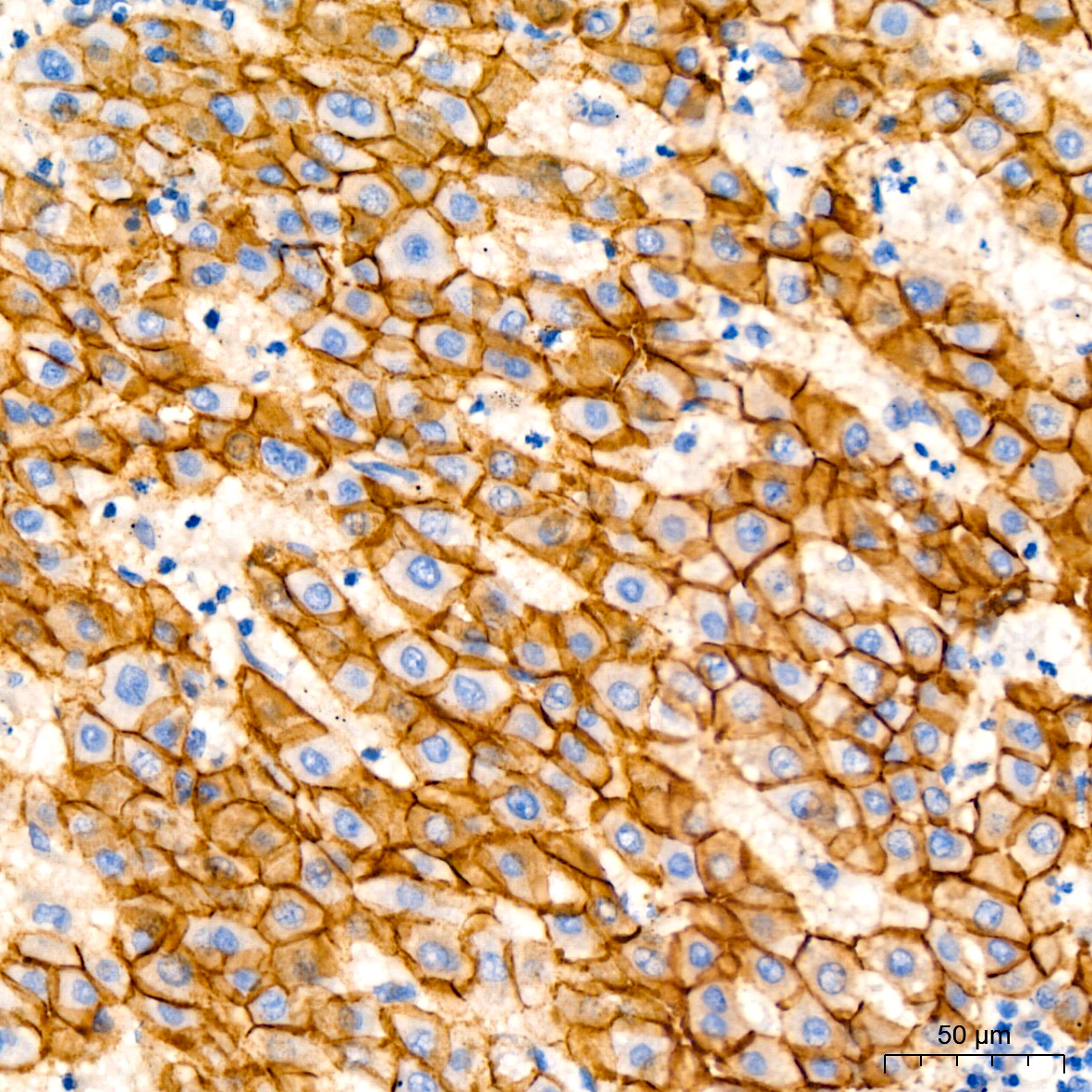 E-Cadherin mouse monoclonal antibody