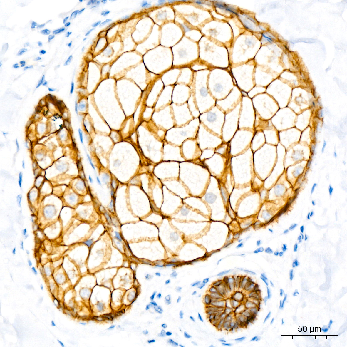 E-Cadherin mouse monoclonal antibody