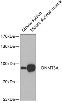 DNMT3A Rabbit polyclonal antibody