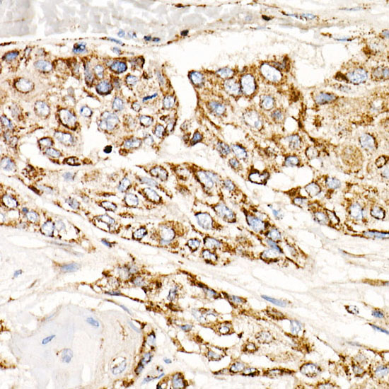 TFAM Rabbit monoclonal antibody