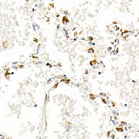 TFAM Rabbit monoclonal antibody