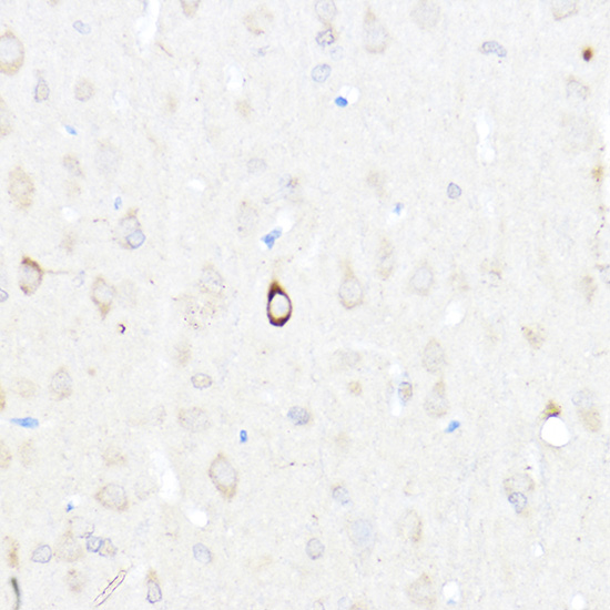 NPY Rabbit polyclonal antibody