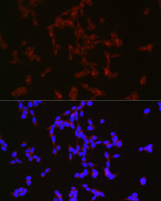 NPY Rabbit polyclonal antibody