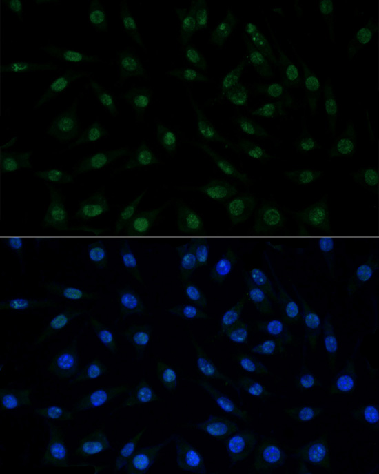 PELP1 Rabbit polyclonal antibody