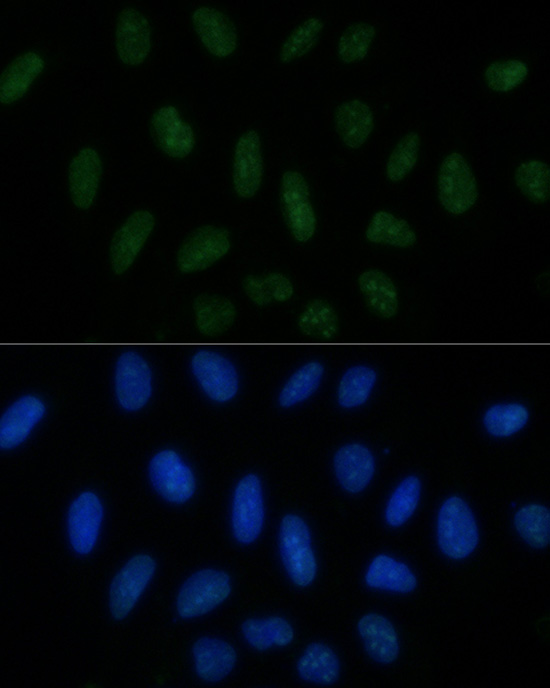 PELP1 Rabbit polyclonal antibody