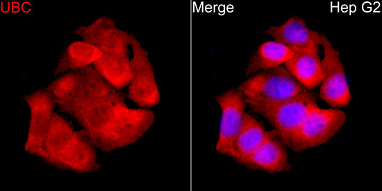 UBC Rabbit polyclonal antibody