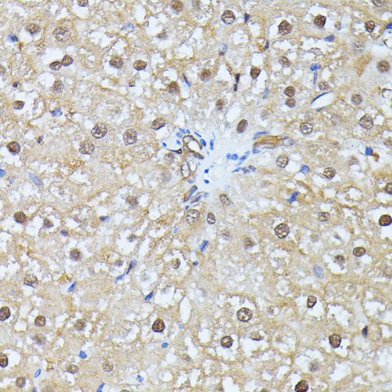 UBC Rabbit polyclonal antibody