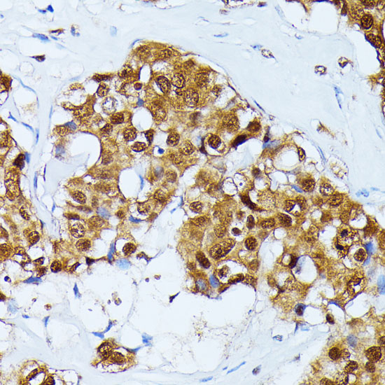 UBC Rabbit polyclonal antibody