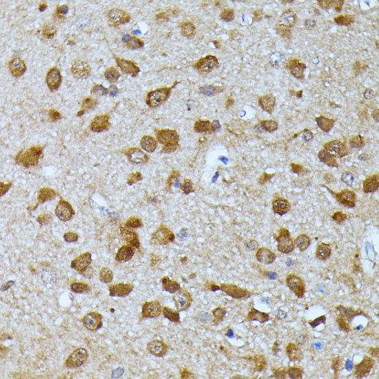 UBC Rabbit polyclonal antibody