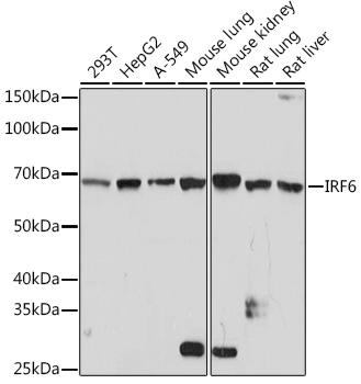 IRF6 Rabbit monoclonal antibody