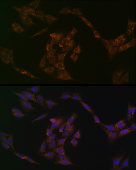 IRF6 Rabbit monoclonal antibody