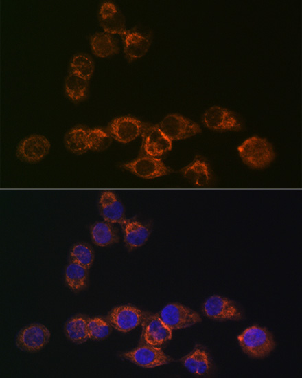 IRF6 Rabbit monoclonal antibody
