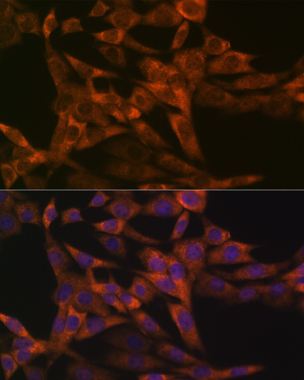 IRF6 Rabbit monoclonal antibody