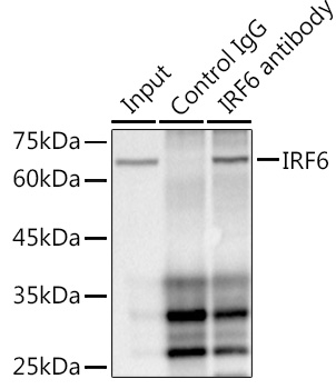 IRF6 Rabbit monoclonal antibody