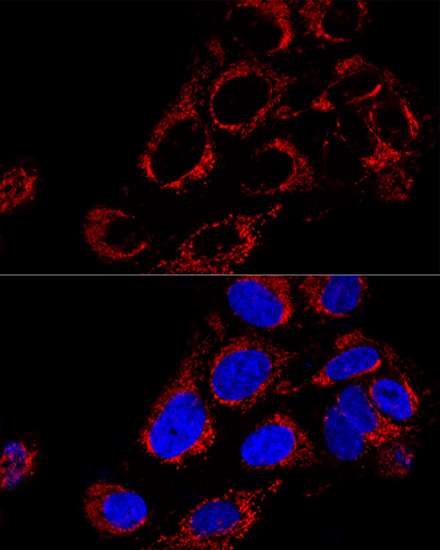 TOMM40 Rabbit polyclonal antibody