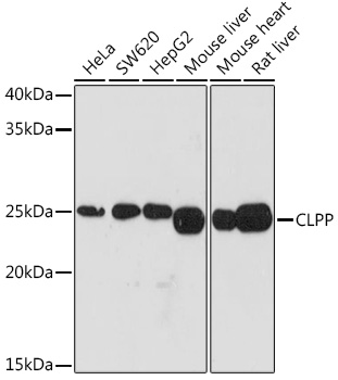 CLPP Rabbit monoclonal antibody