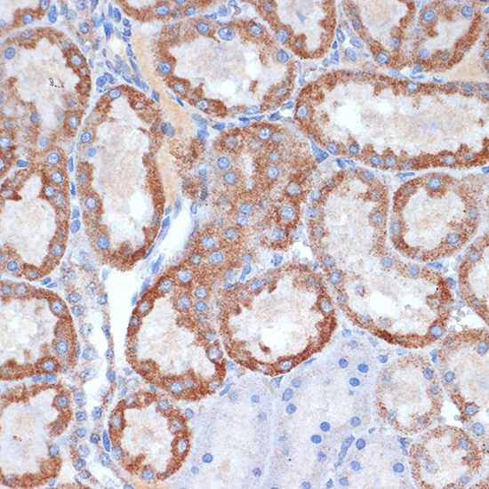 CLPP Rabbit monoclonal antibody