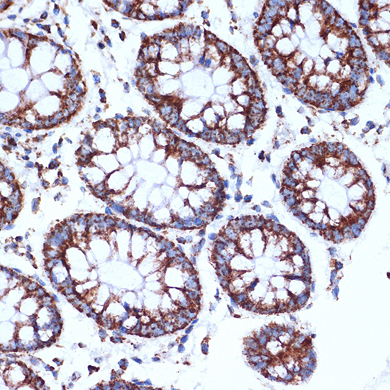 CLPP Rabbit monoclonal antibody