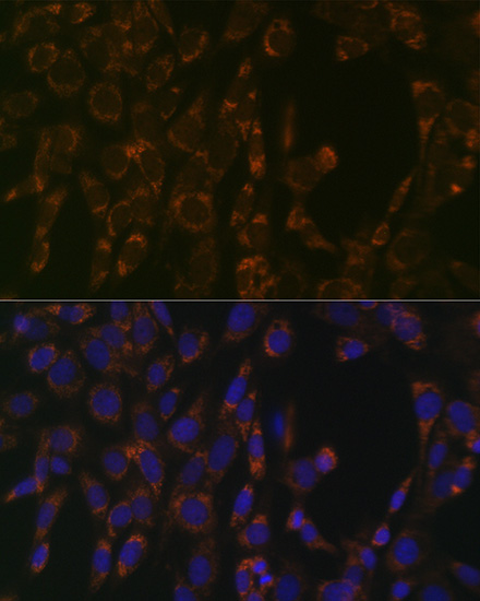 CLPP Rabbit monoclonal antibody