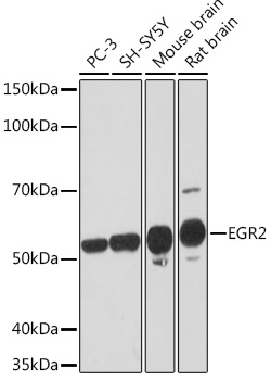EGR2 Rabbit monoclonal antibody