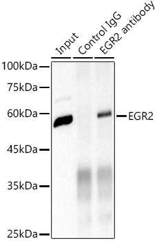 EGR2 Rabbit monoclonal antibody