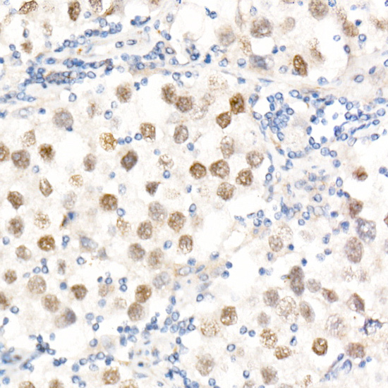 Nanog Rabbit polyclonal antibody