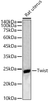 Twist Rabbit polyclonal antibody