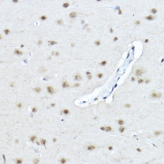 Twist Rabbit polyclonal antibody