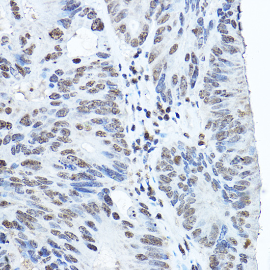 Twist Rabbit polyclonal antibody