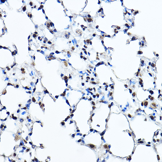 Twist Rabbit polyclonal antibody