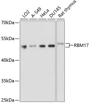 RBM17 Rabbit polyclonal antibody
