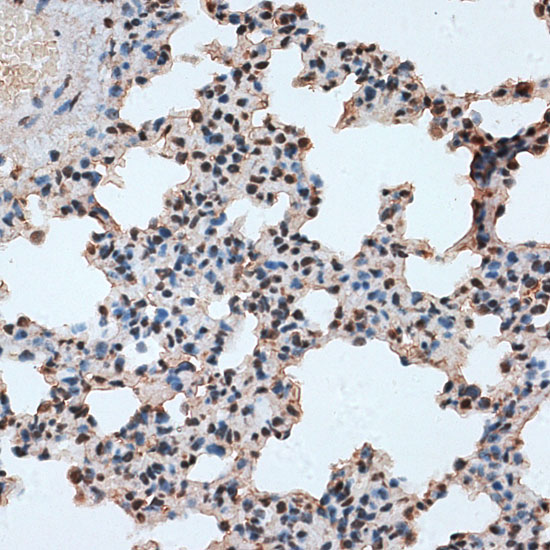 RBM17 Rabbit polyclonal antibody