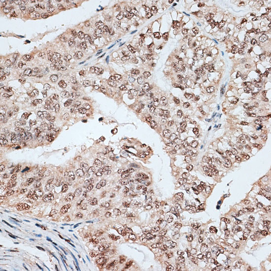 RBM17 Rabbit polyclonal antibody