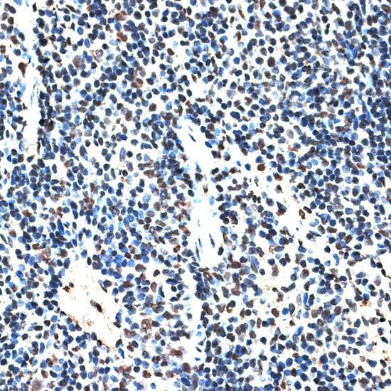 RBM17 Rabbit polyclonal antibody