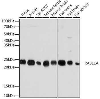 RAB11A Rabbit monoclonal antibody