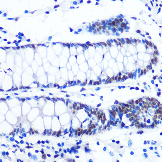 NRF1 Rabbit monoclonal antibody