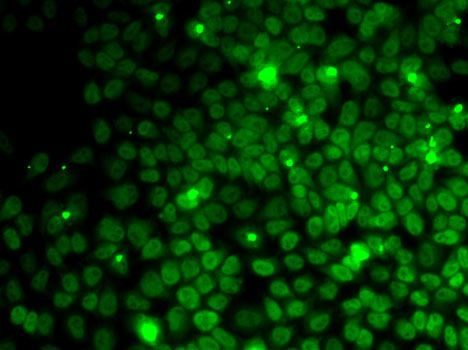 UFD1L Rabbit polyclonal antibody